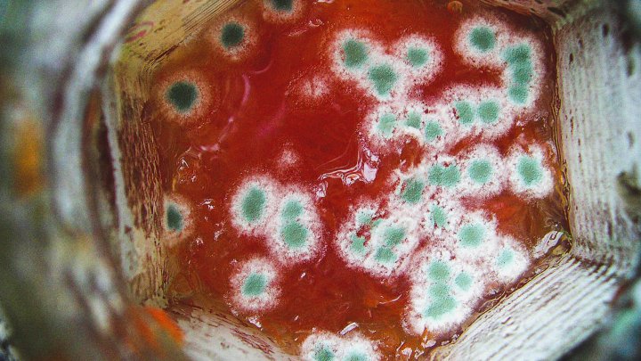 Gıda Zehirlenmeleri Nasıl Önlenir?